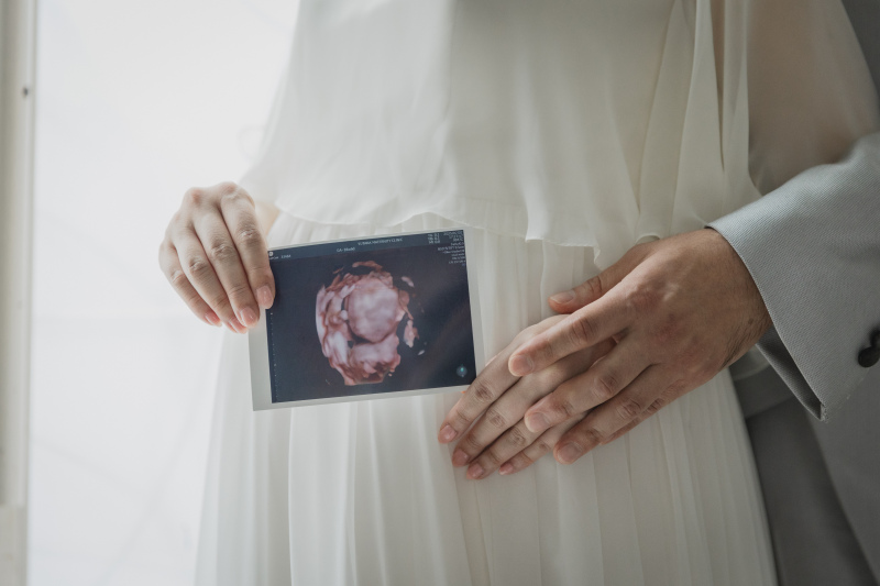 マタニティショット