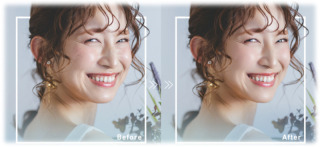 美肌補正+痩身・小顔補正(100カット)