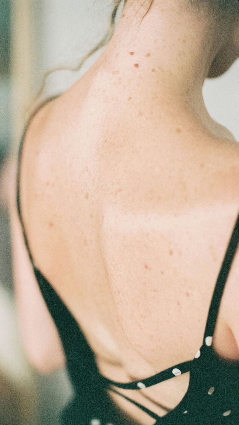 ヘアメイクの技術 写真1 before