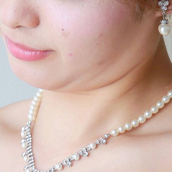 ヘアメイクの技術 写真1 before