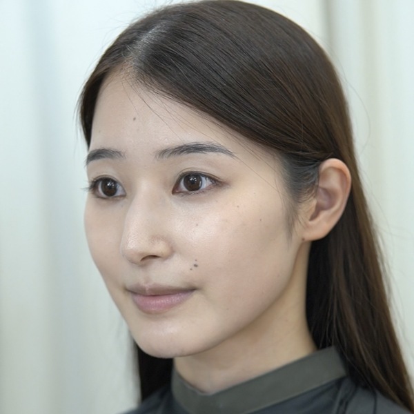 ヘアメイクの技術 写真1 before