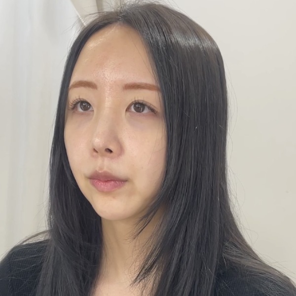ヘアメイクの技術 写真1 before