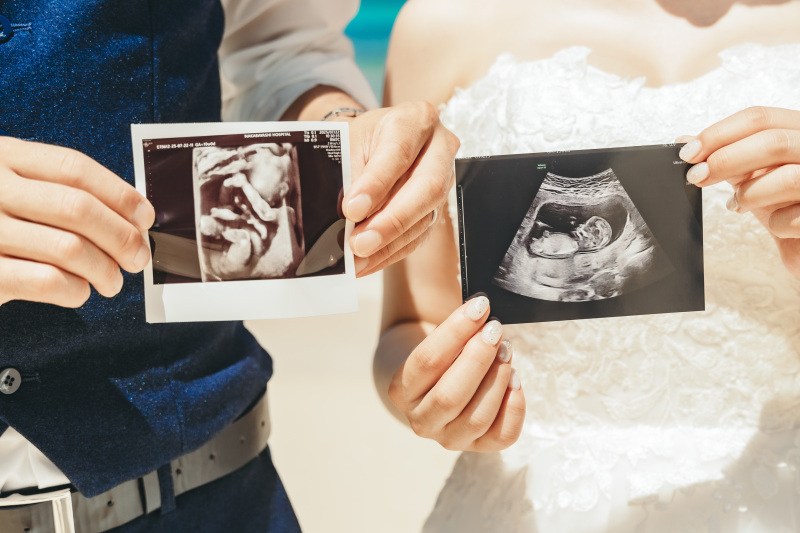 picmy(ピクミィ) by capryフォトウェディング_マタニティフォトの撮影ができる